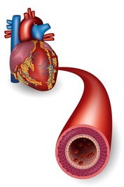 Abgedrückte Arterie im Genick - plötzlicher Kindstod